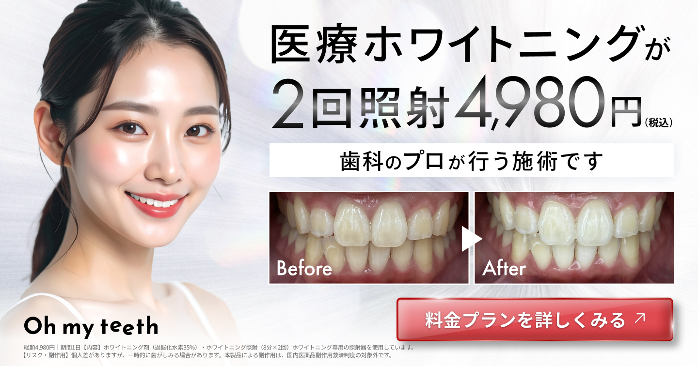 ホワイトニングエリア記事バナー