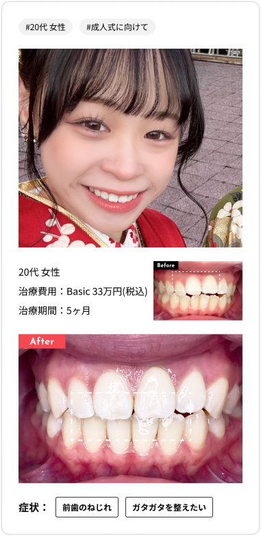 voice card06