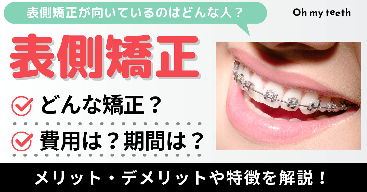 表側矯正　アイキャッチ