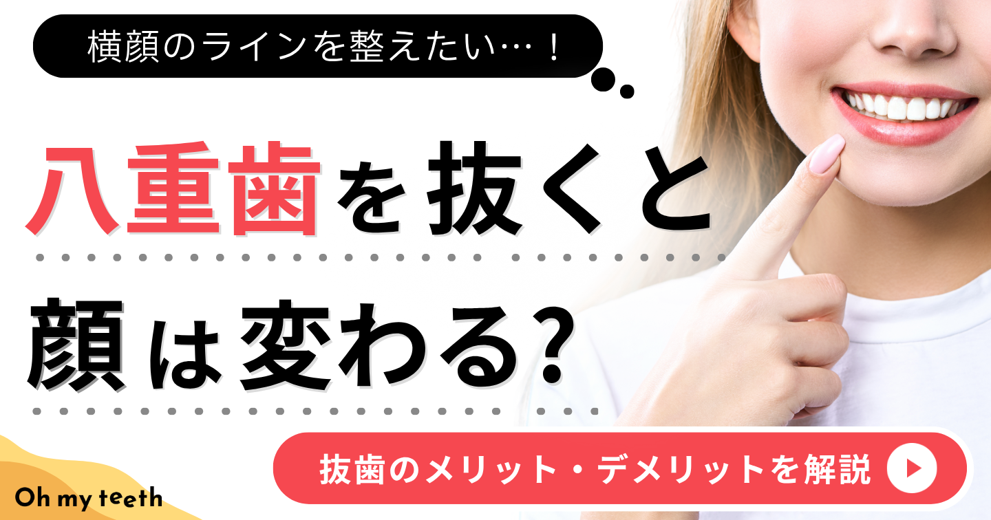 八重歯 を抜くと　アイキャッチ