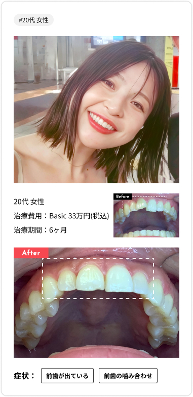 voice card05