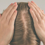 Sensitive Scalp 2