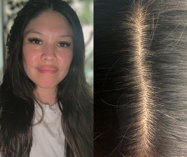 I Washed My Hair for 10 Days, Here’s What Happened