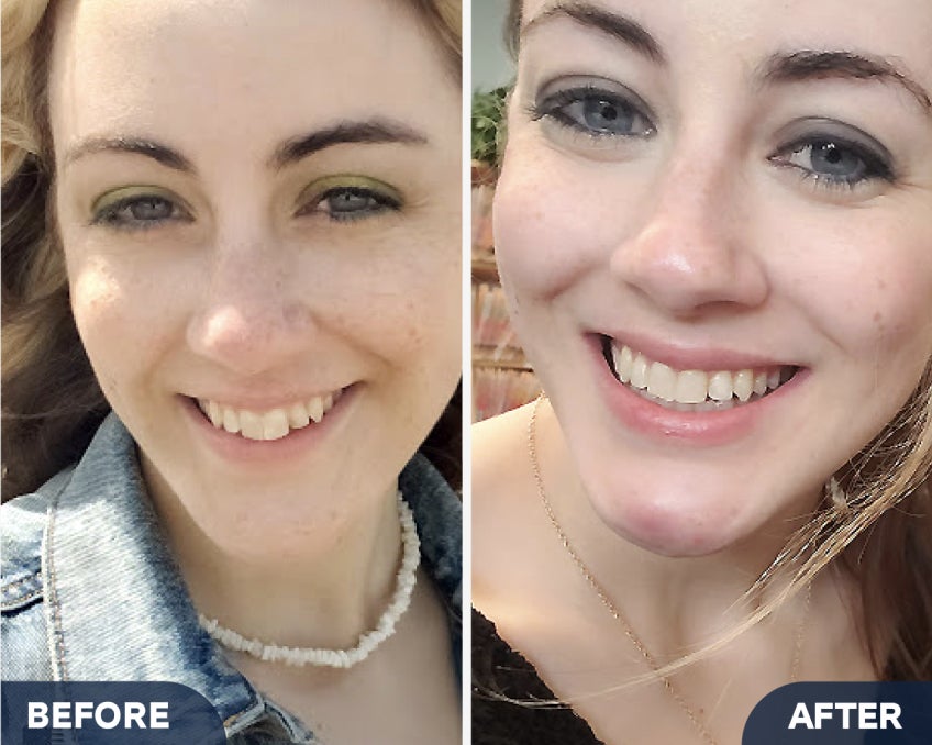 Before and after images of a woman named Paige Y. from Woburn, MA, highlighting her smile transformation with Motto clear aligners. The before image shows her natural smile, while the after image displays a straighter, more aligned smile. A testimonial below reads, “All of the changes helped improve my confidence and even my bite.”