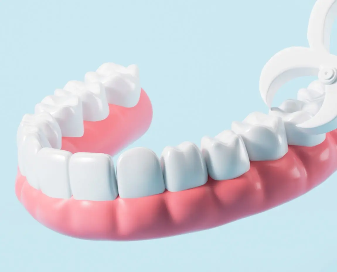 3D illustration of a dental arch with a tooth being extracted using forceps, visually representing the tooth removal process at Aspen Dental.