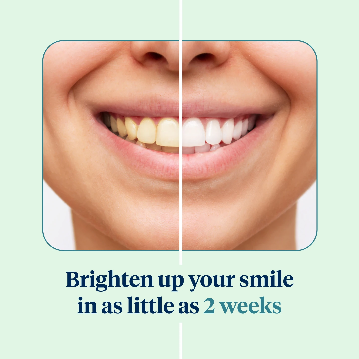 Brighten up your smile in as little as 2 weeks. 