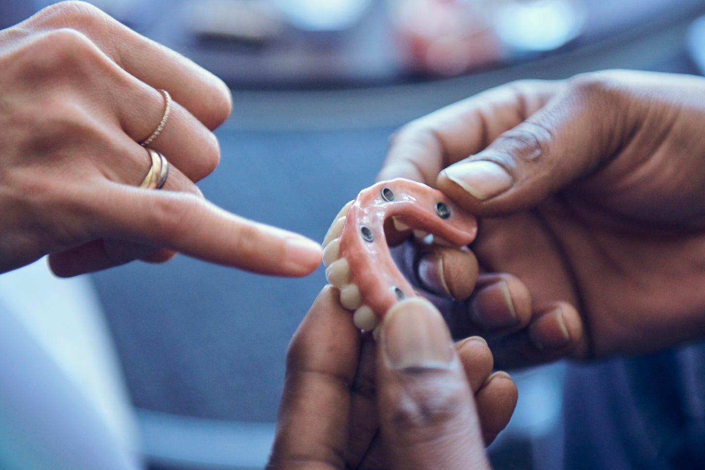 A ClearChoice dentist explaining the benefits and procedure of the upper arch dental implant to a patient.