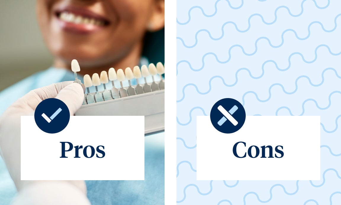 A dentist holds a shade guide next to a patient's smile on the left panel labeled "Pros," and a wavy blue background on the right panel labeled "Cons.