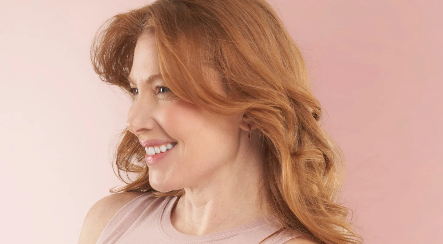 Chapter guest after a PDO thread lift.