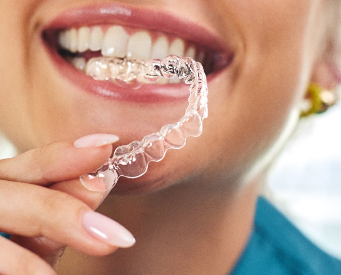 A person smiling and holding a clear aligners near their teeth, preparing to insert it.