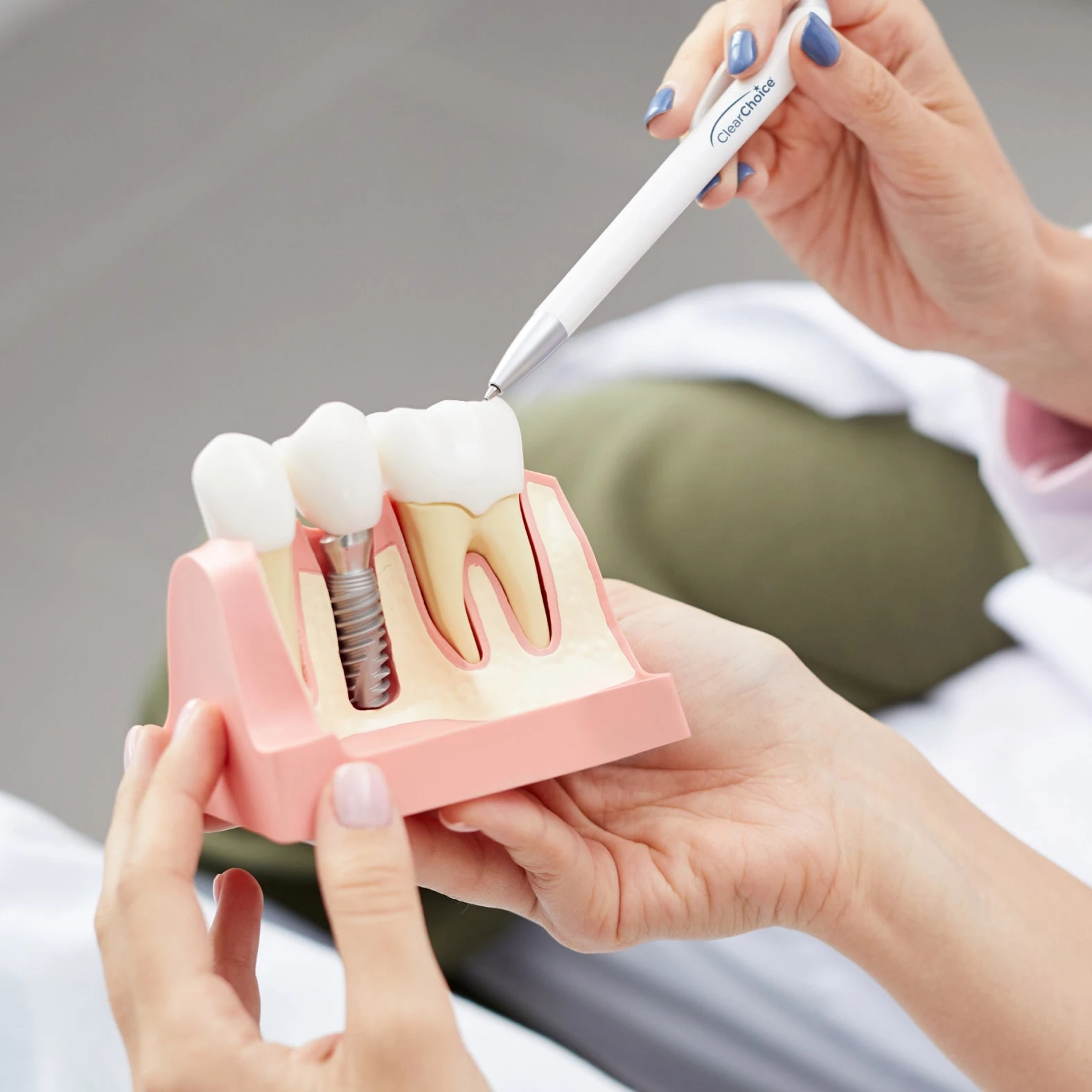 Single Tooth Dental Implants for Lasting Confidence ClearChoice