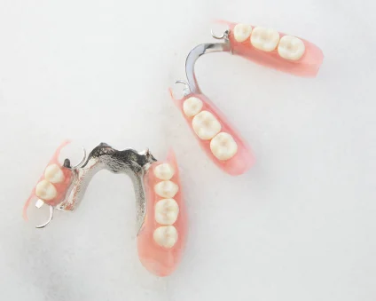 Aspen Dental dentures sit on a white background. 