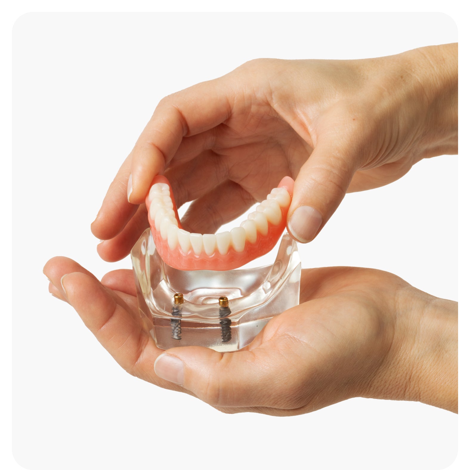 Hands holding an Aspen Dental implant denture model to demonstrate realistic fit and function with implant-supported dentures.