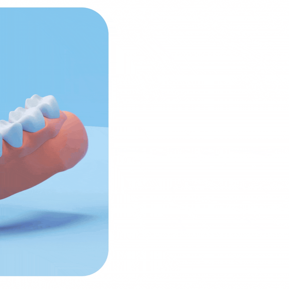A gif displaying different types of dental implants available at Aspen Dental, on a blue background.