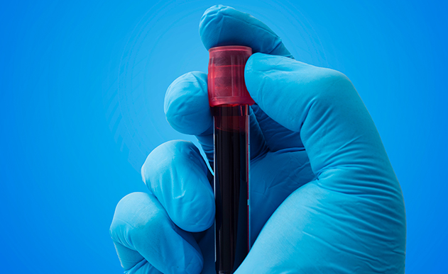 MT Group Blood Sample Collection Study