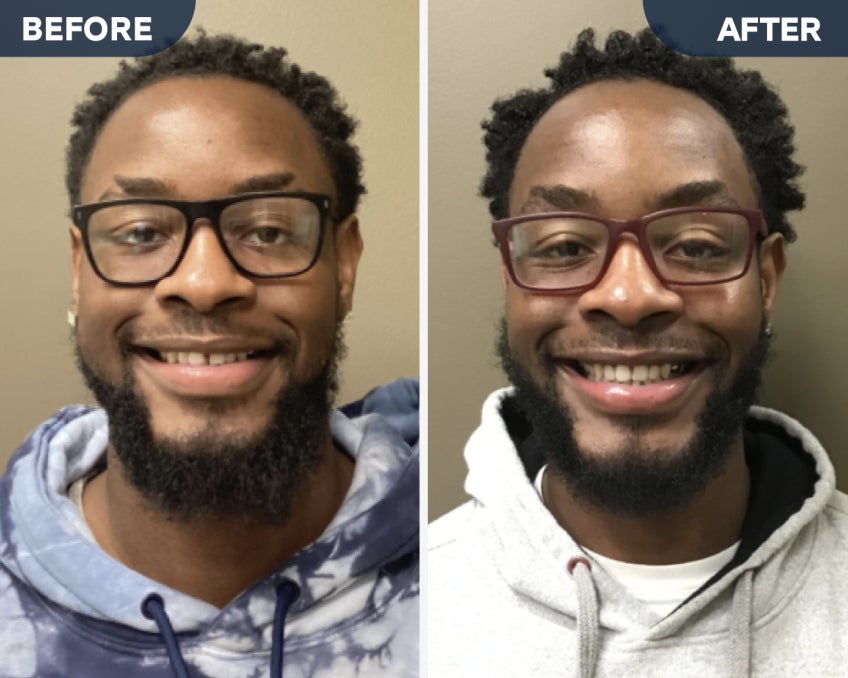 Before and after images of a man named Maurice D. showcasing his smile transformation with Motto clear aligners. In the before image, he wears a relaxed smile, while in the after image, his teeth appear straighter and more aligned. A testimonial below reads, “They have it all down to a science. They knew exactly what they were doing and they were efficient in doing it.”