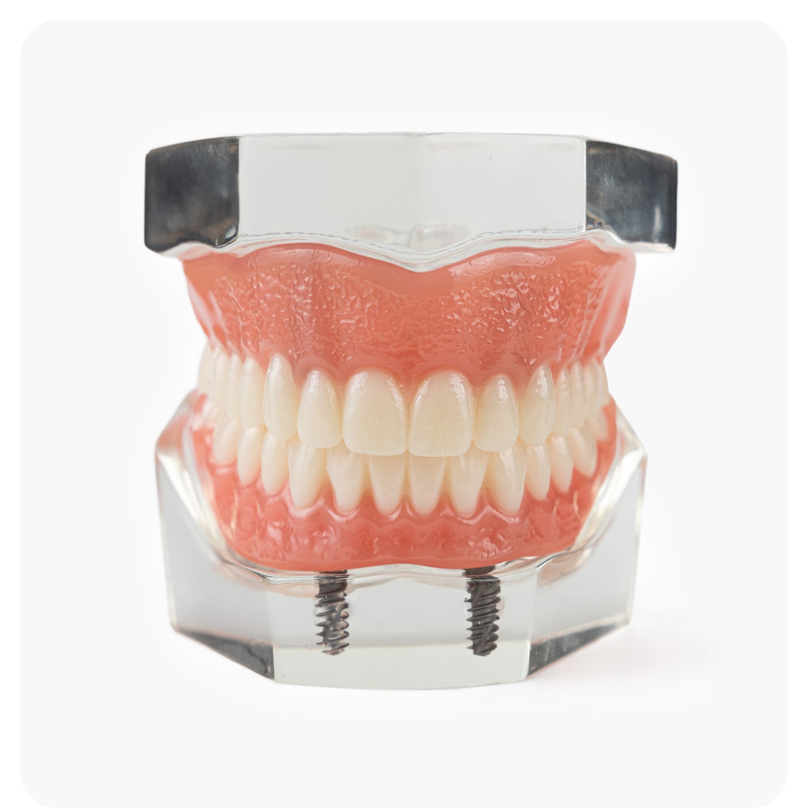 Aspen Dental full arch implant denture model showcasing fixed upper dentures supported by dental implants for strong bite performance.