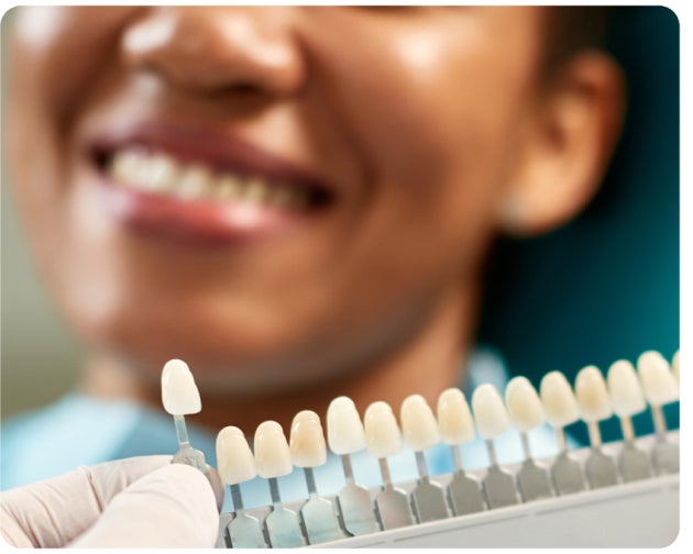 A person smiling while a dental professional holds a tooth shade guide next to their teeth for color matching, ensuring the perfect fit for their new dental veneers.