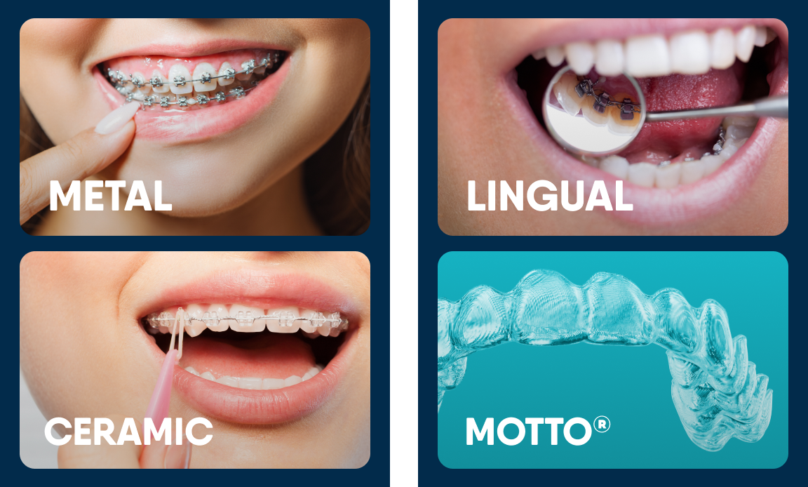 Guide to Adult Orthodontics | Motto Aligners from Aspen Dental