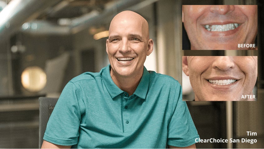 A man in a blue shirt is smiling in front of a before and after photo