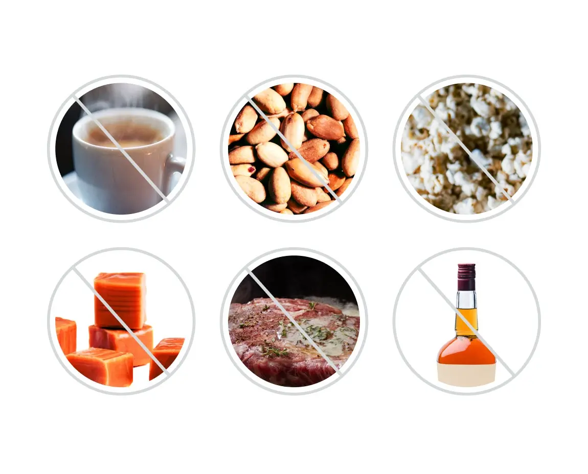 A visual of six foods and beverages to avoid getting a root canal treatment: coffee, nuts, popcorn, sticky candy, raw meat, and alcohol, each crossed by a diagonal line. These are also important foods to avoid after getting a root canal for optimal recovery.