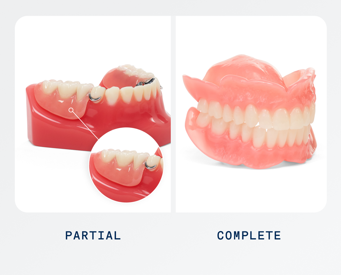 A comparison of partial and complete dentures. The left side shows partial dentures attached to remaining teeth with natural material, while the right side displays full upper and lower dentures.