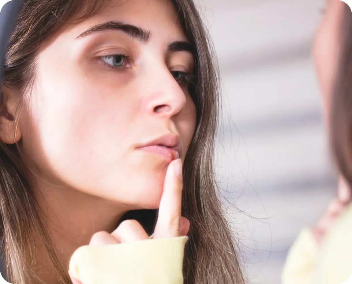 A young woman gently touches the inside of her lip, indicating mouth discomfort commonly associated with canker sores. The image highlights oral health concerns.