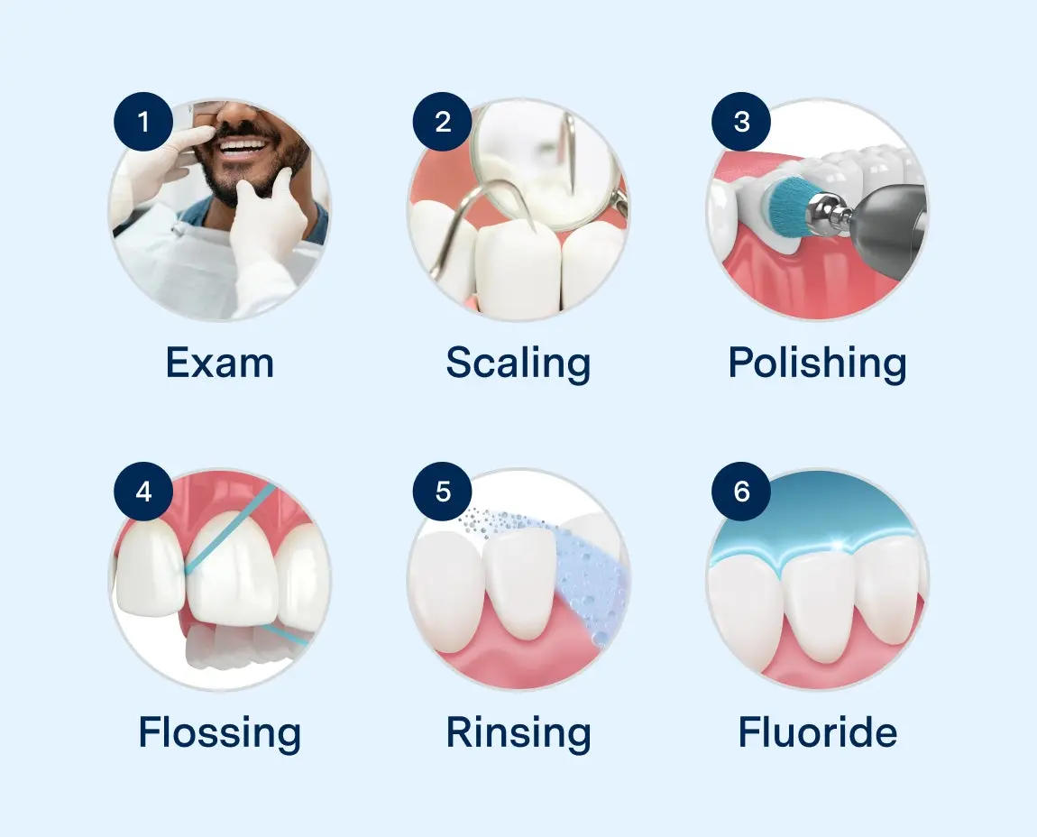 Graphic illustrating the six steps of a dental cleaning at Aspen Dental, including exam, scaling, polishing, flossing, rinsing, and fluoride application.