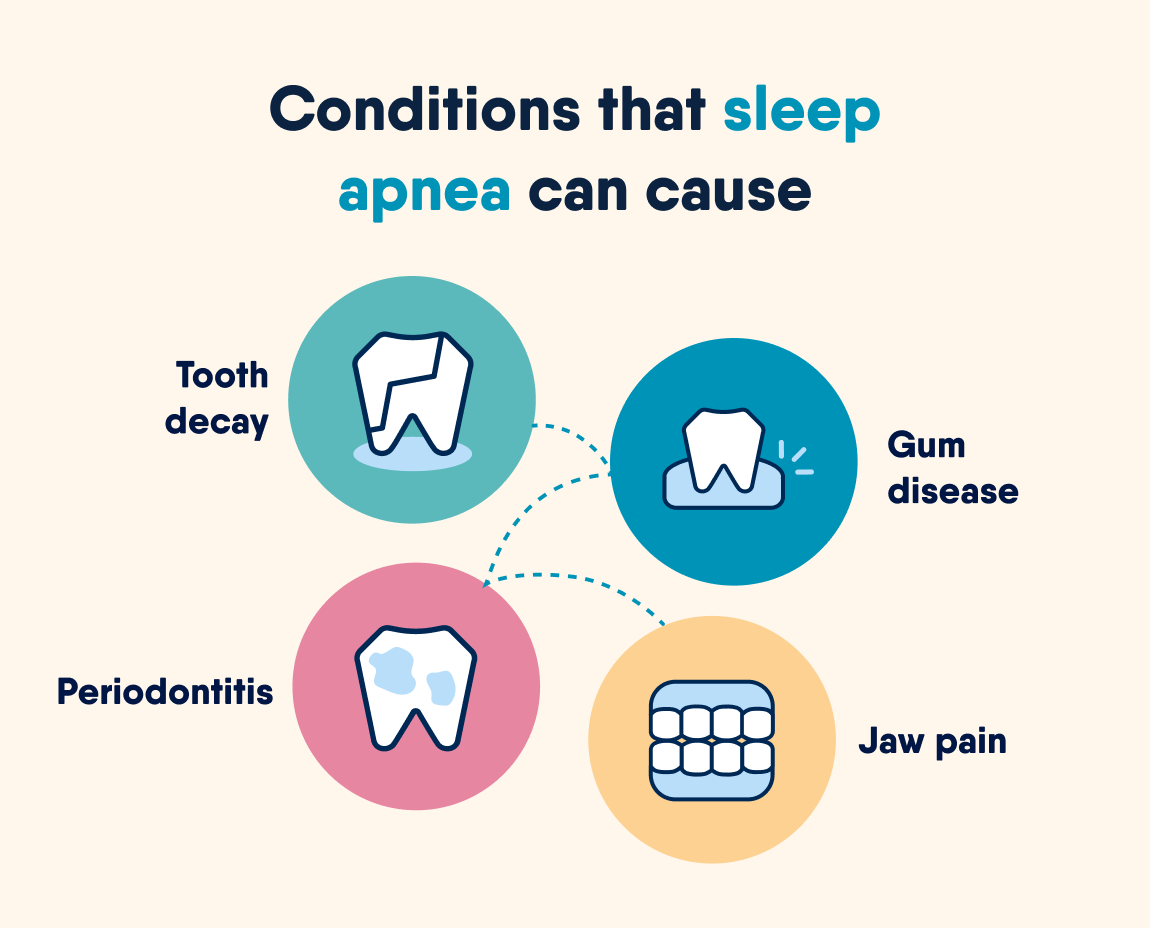 Infographic titled "Conditions that sleep apnea can cause" with illustrations showing conditions like: tooth decay, gum disease, periodontitis, and jaw pain.