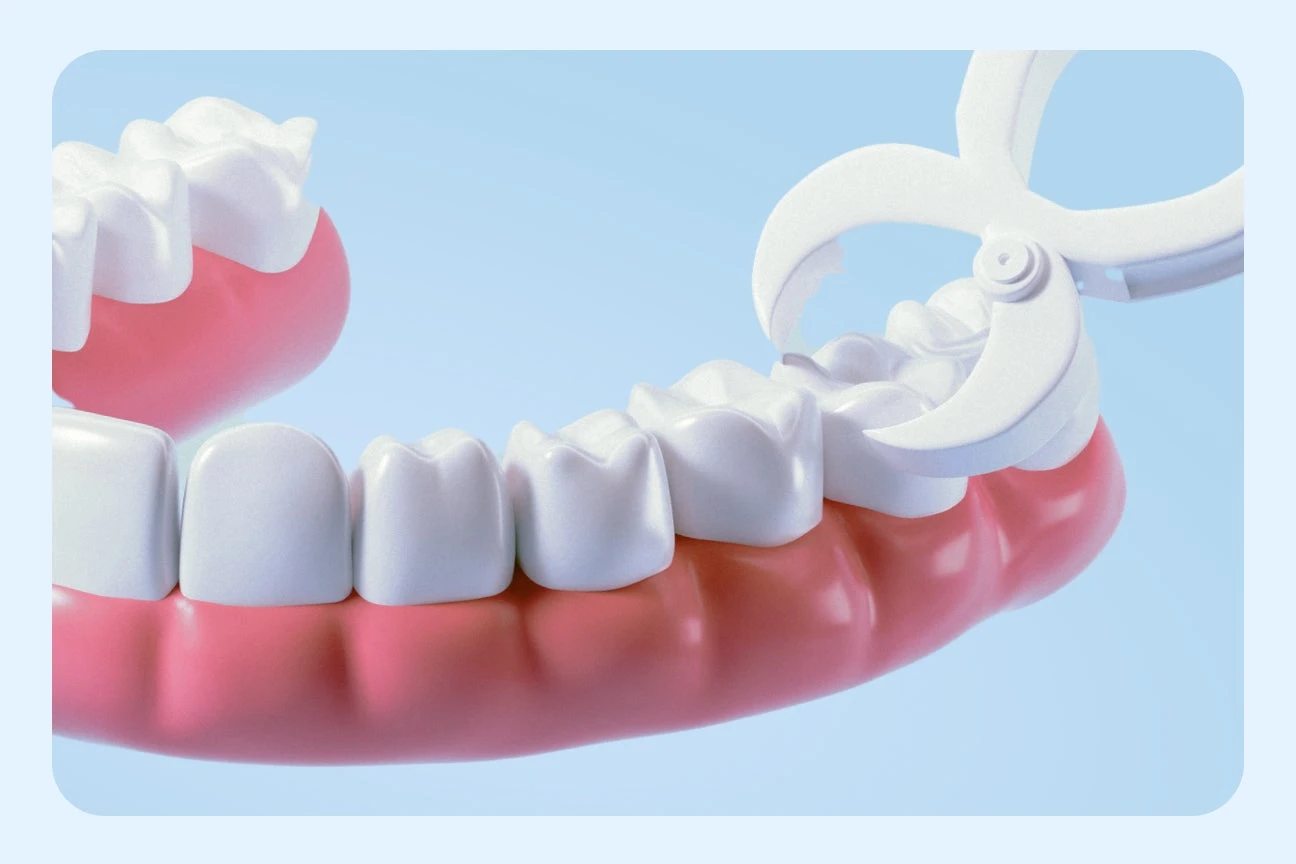 Tooth Extraction in Santa Maria, CA | Aspen Dental