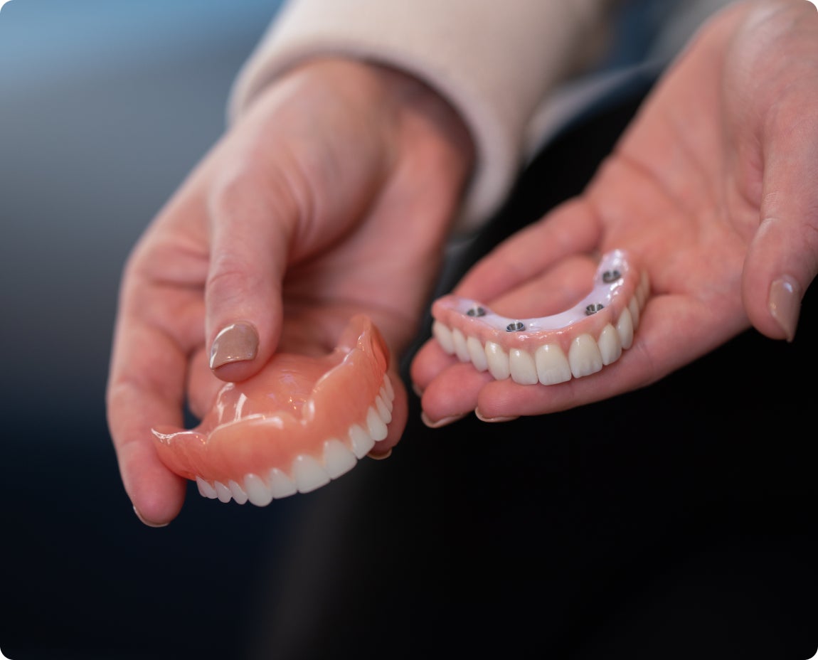 Comparison of traditional dentures and implant-supported dentures held in hands, highlighting the differences in design and functionality, representing ClearChoice services.