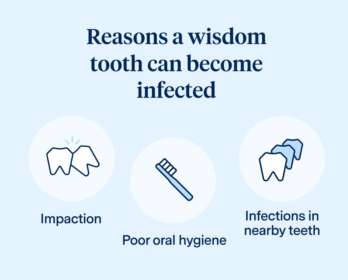 A graphic from Aspen Dental outlining reasons a wisdom tooth can become infected, including impaction, poor oral hygiene, and infections in nearby teeth, with simple icons illustrating each cause.