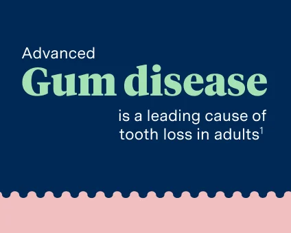 Advanced gum disease is a leading cause of tooth loss in adults.