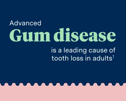 Advanced gum disease is a leading cause of tooth loss in adults. 