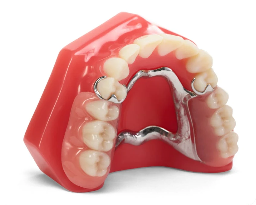 Partial Dentures Cost: Custom, Affordable Options | Aspen Dental