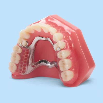 Aspen Dental Flexilytes Combo Dentures. 