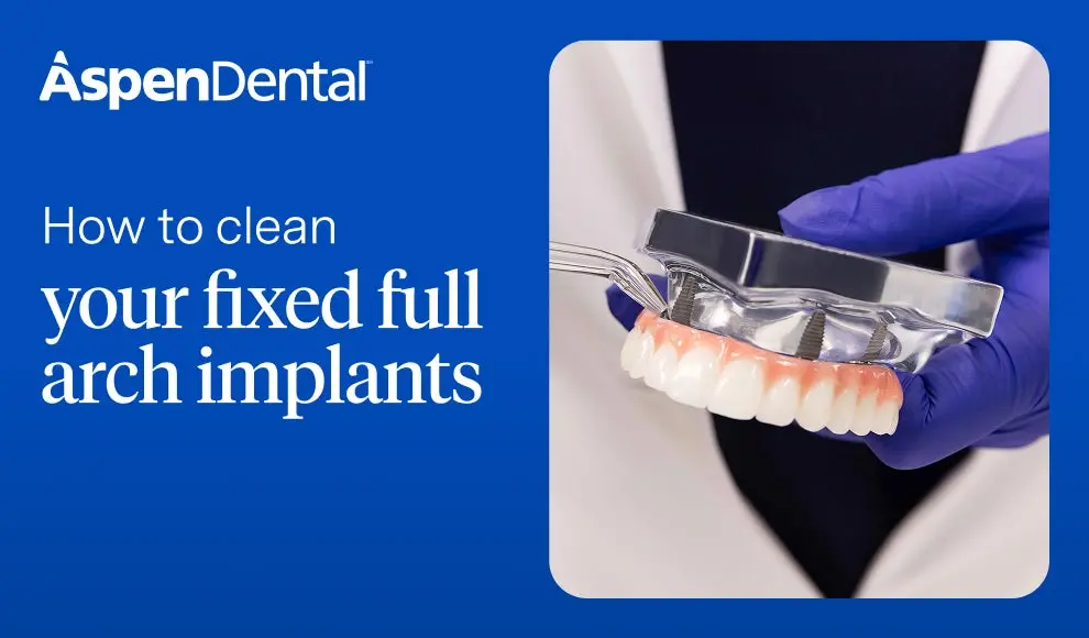  Aspen Dental provider discussing how to clean fixed full arch dental implants – oral hygiene guide.