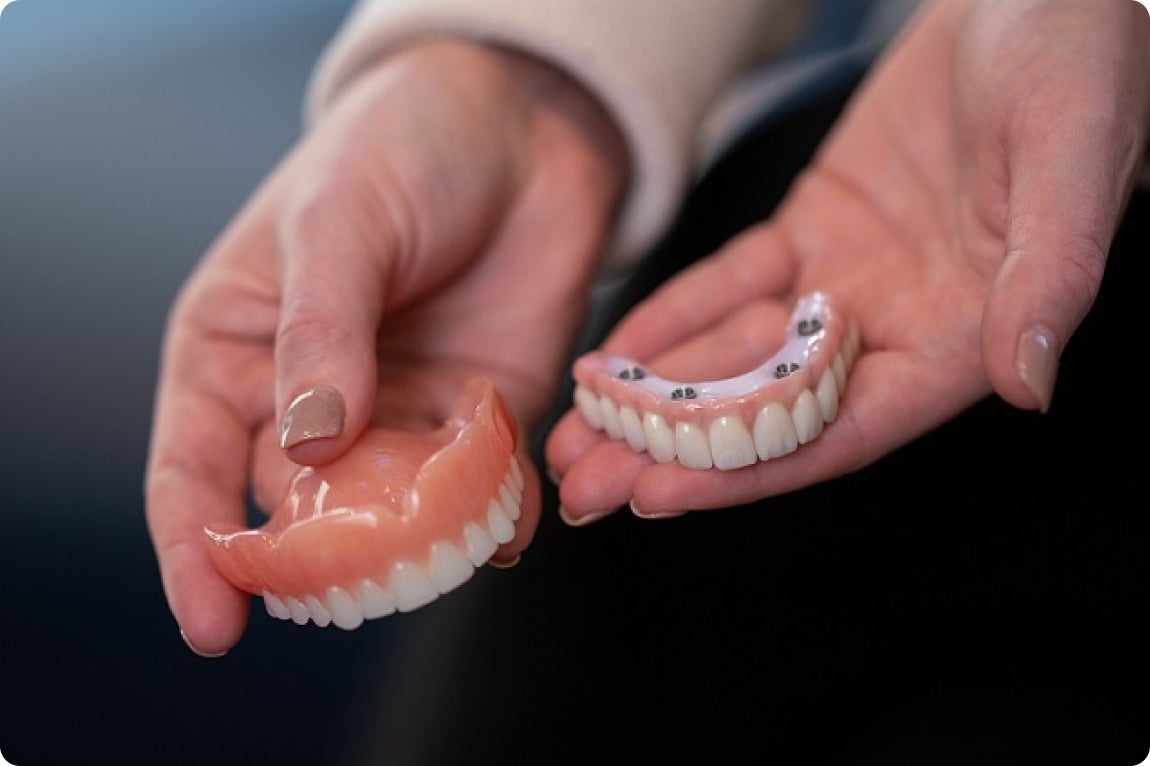 Close-up of a person holding a traditional denture in one hand and a zirconia implant-supported arch in the other, illustrating the difference in dental restoration options.
