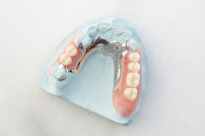 Aspen Dental partial dentures sit on a white background. 