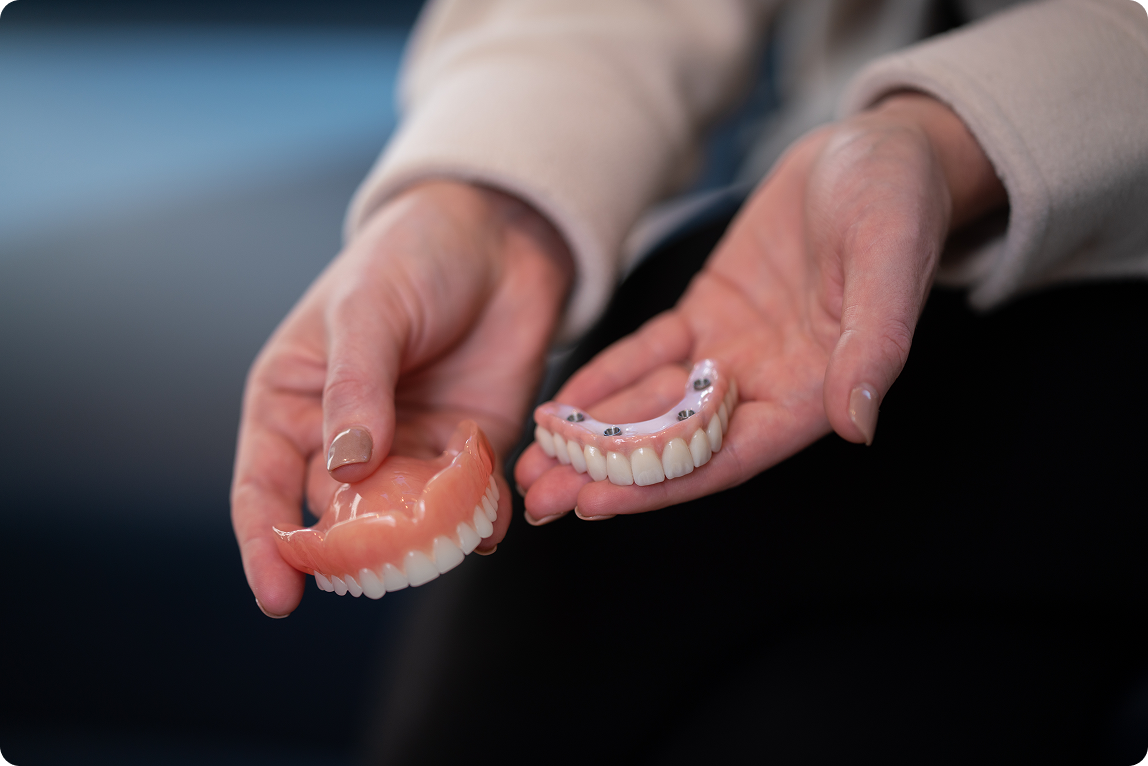 hands holding removable dentures and implant-supported teeth to compare dental implants vs dentures, highlighting differences in stability, comfort, and long-term tooth replacement options