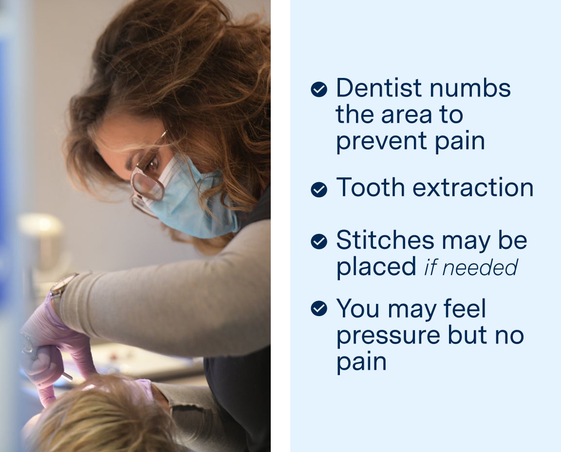  Dentist at Aspen Dental performing a tooth extraction, with a list of steps including numbing, extraction, optional stitches, and reassurance of no pain but possible pressure.