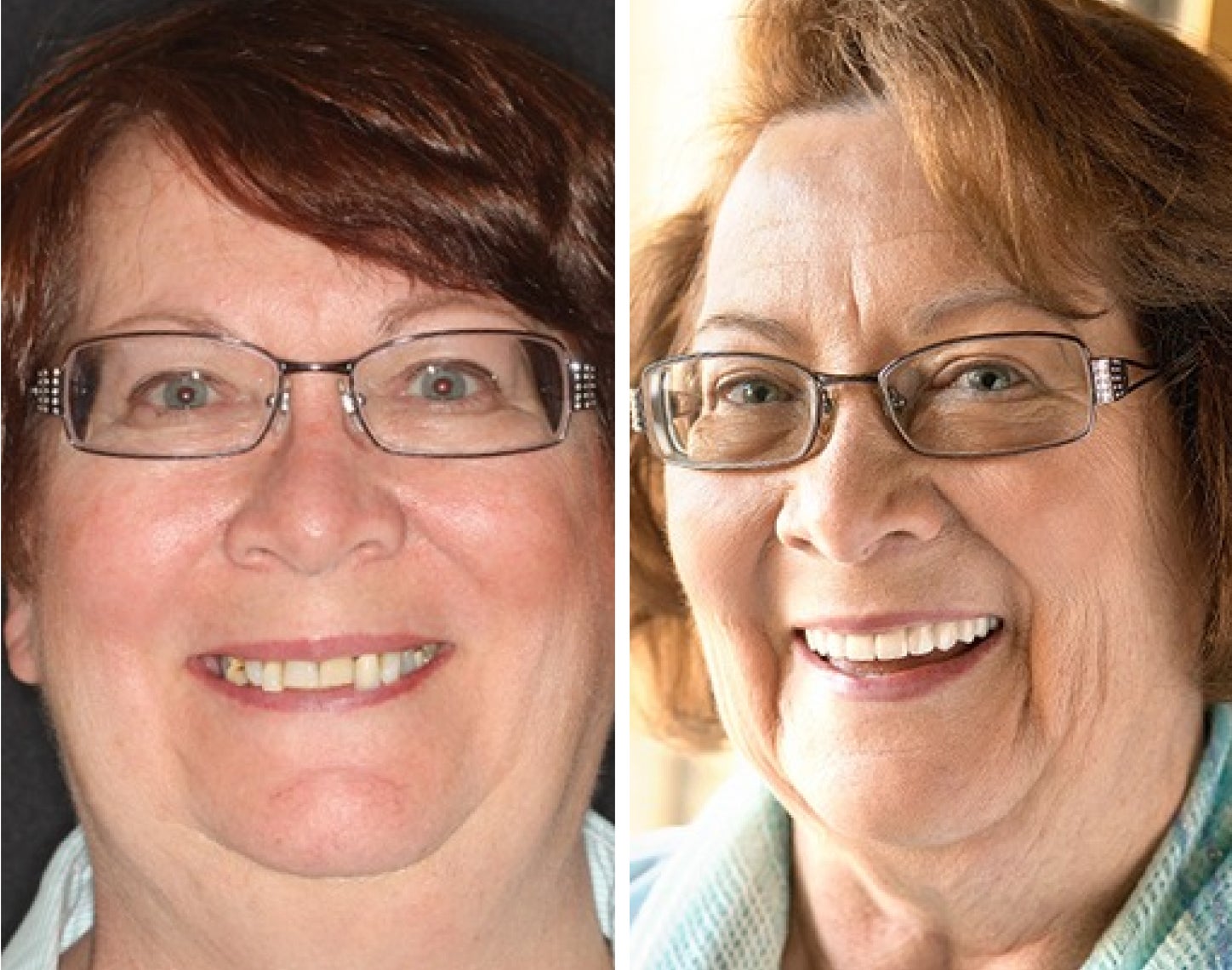 A before and after photo of a woman wearing glasses