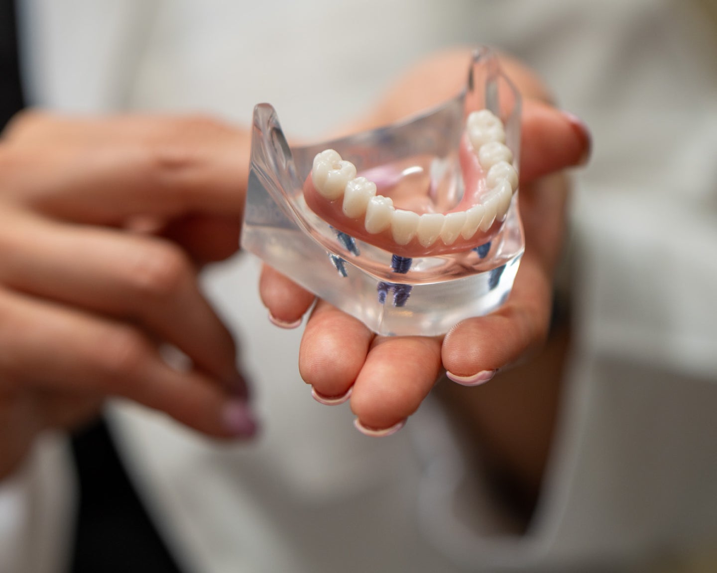 A woman is holding a model of dentures in her hands