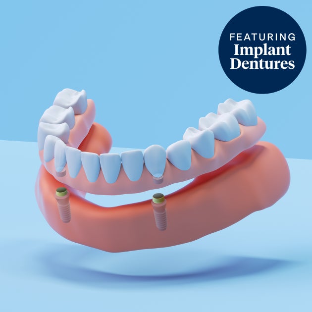 3D illustration of implant-supported dentures featuring dental implants and lower dentures on a blue background.