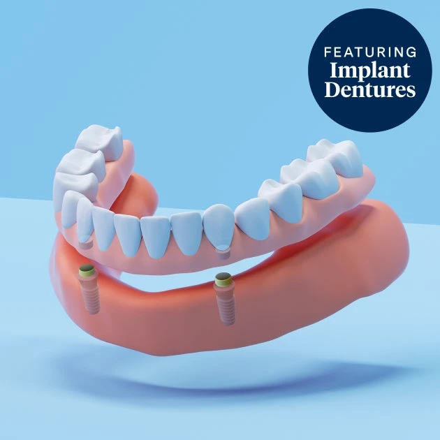 3D illustration of implant-supported dentures featuring dental implants and lower dentures on a blue background.