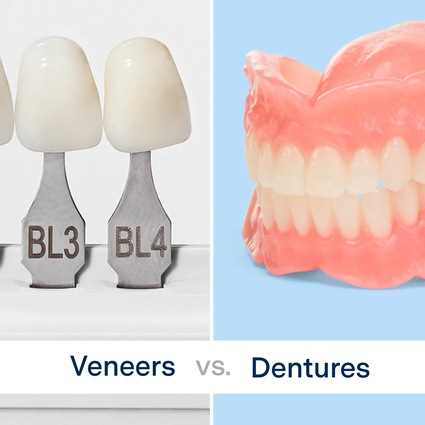 Image divided into two halves: Left side displaying various veneer options, and the right side featuring dentures. A visual guide to dental solutions for smile enhancement and restoration.