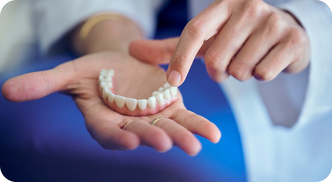 A ClearChoice provider holds a lower arch removable denture model, explaining how implant-supported options can replace traditional dentures after years of wear—providing improved stability and function.