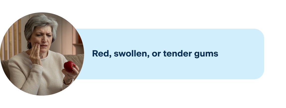 An image showing one of the common symptoms of an infected implant, including red, swollen, or tender gums.