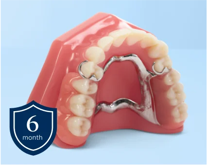 Aspen Dental cast partial dentures. 