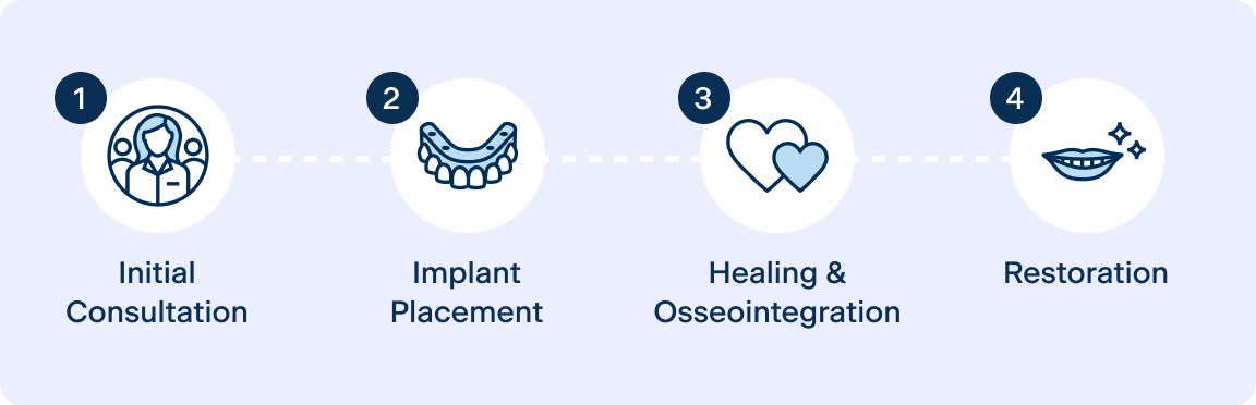 An infographic showing the steps of the dental implant process, including initial consultation, making a payment, undergoing the procedure, and completing recovery. Each step is represented by an icon with corresponding text, visually explaining the dental implant journey.